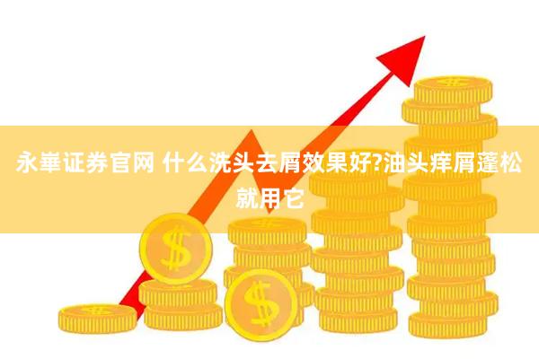 永崋证券官网 什么洗头去屑效果好?油头痒屑蓬松就用它